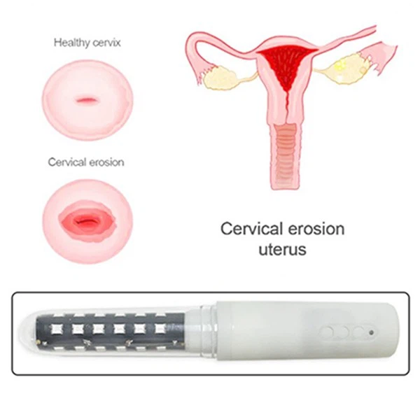 pelvic floor red light therapy