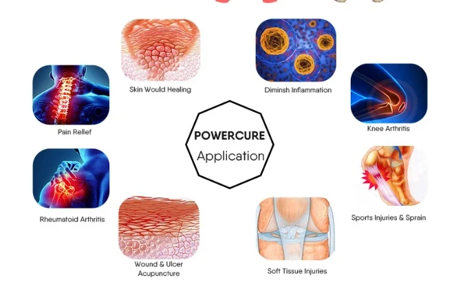 acupuncture and laser therapy1