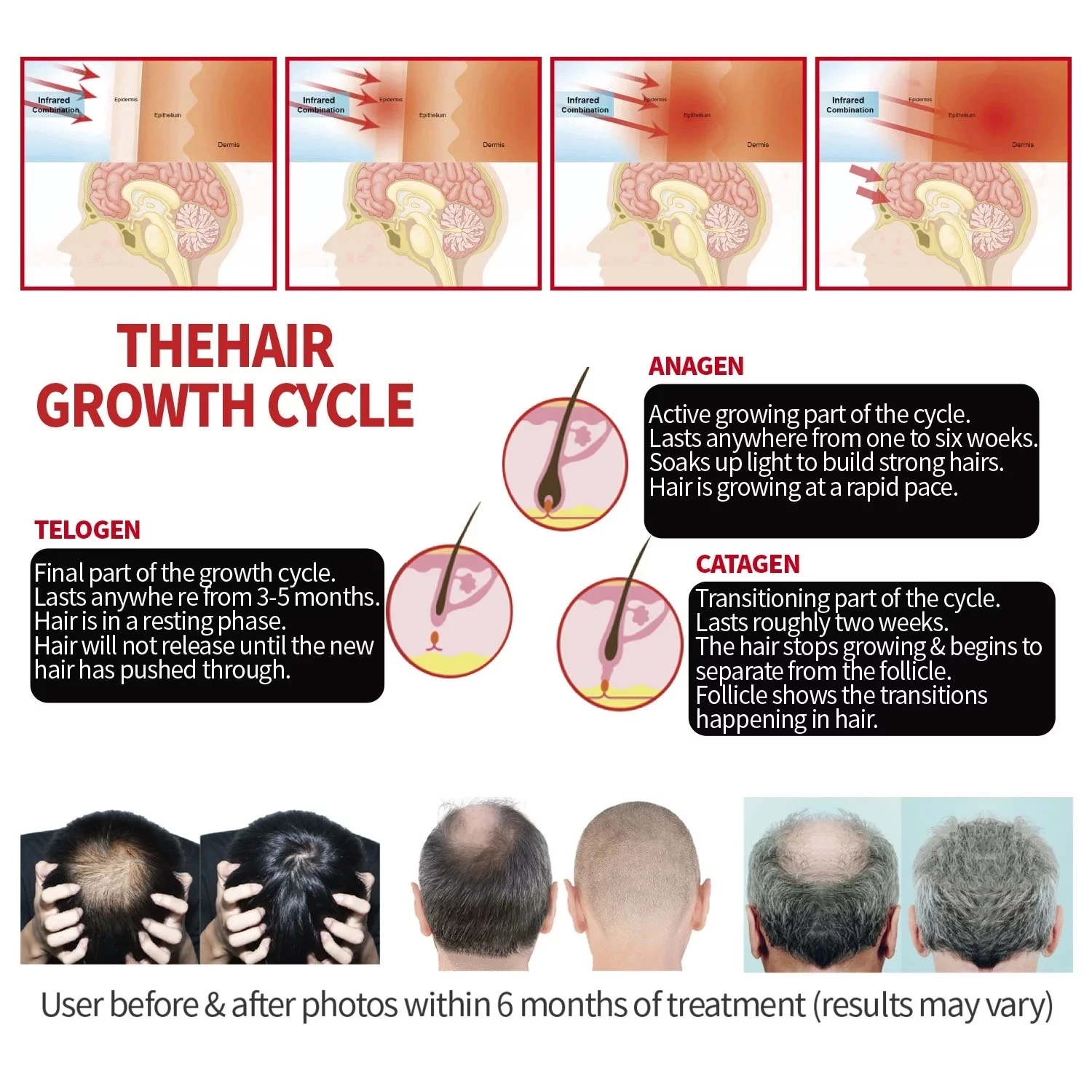 hair growth led cap