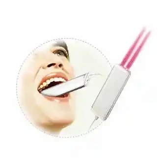 laser treatment for tooth cavity