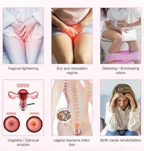 laser treatment for vaginal atrophy1