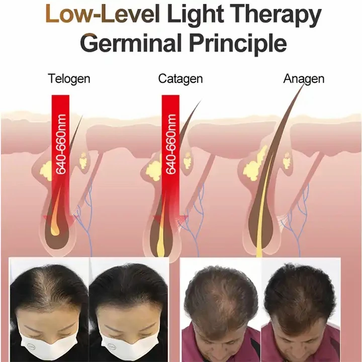 laser hair therapy cap1