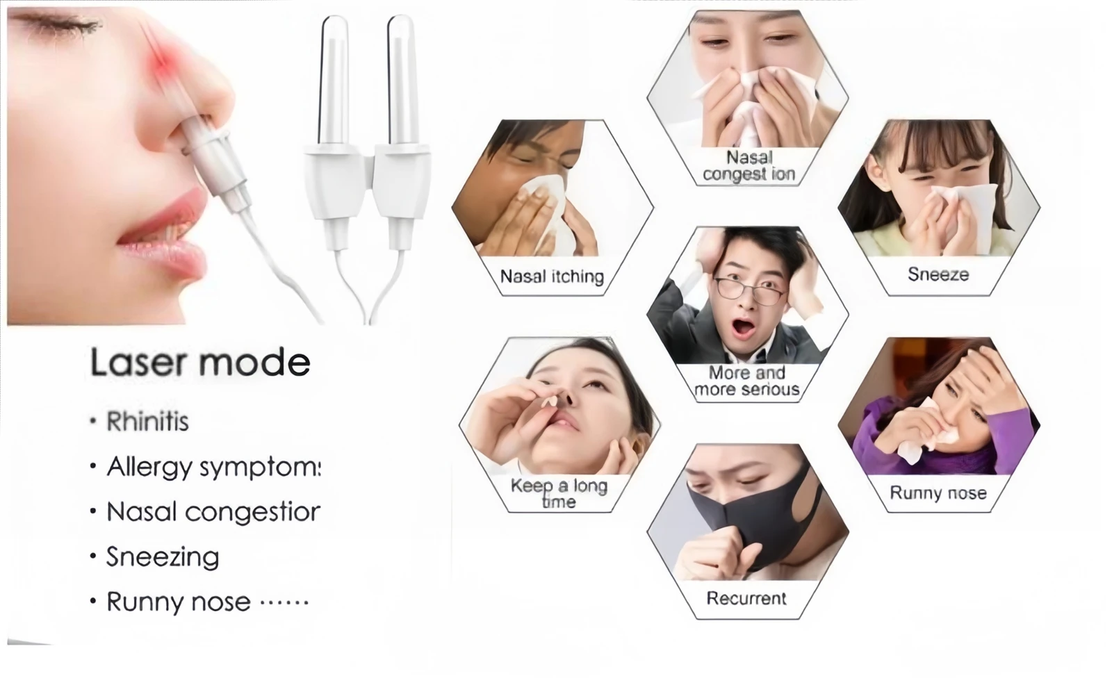laser treatment for tinnitus