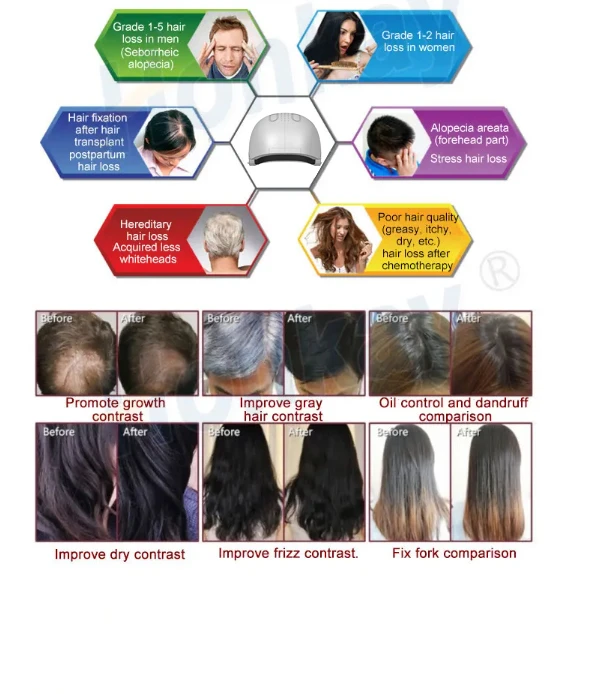 light cap for hair growth