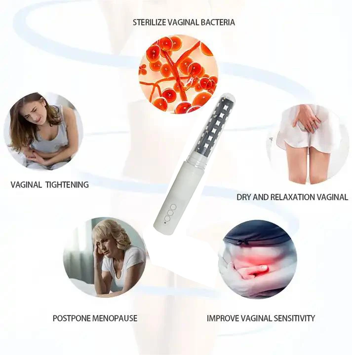 Vaginal Laser Resurfacing